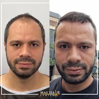 May hair center. 4500 Greft

İletişim

☎️ +90 533 634 30 04
☎️ +90 542 138 46 08
