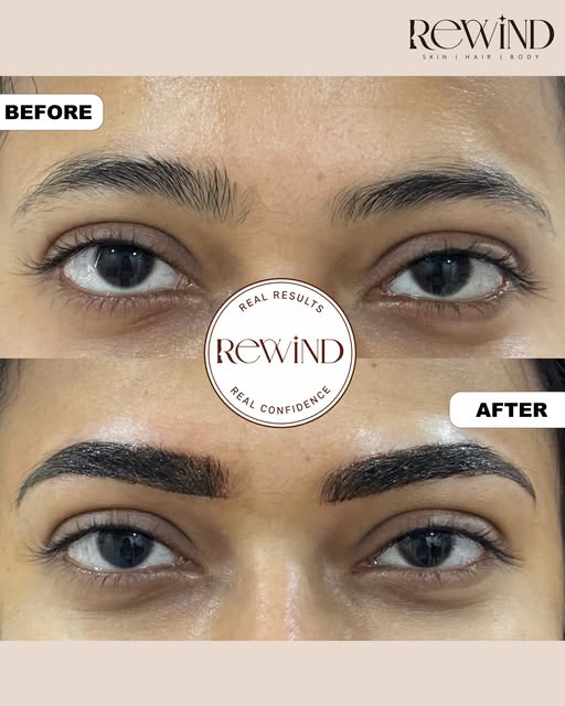 ✨ BEFORE → AFTER | PERMANENT EYEBROW TREATMENT ✨

Sparse & uneven eyebrows?
Get beautifully defined 