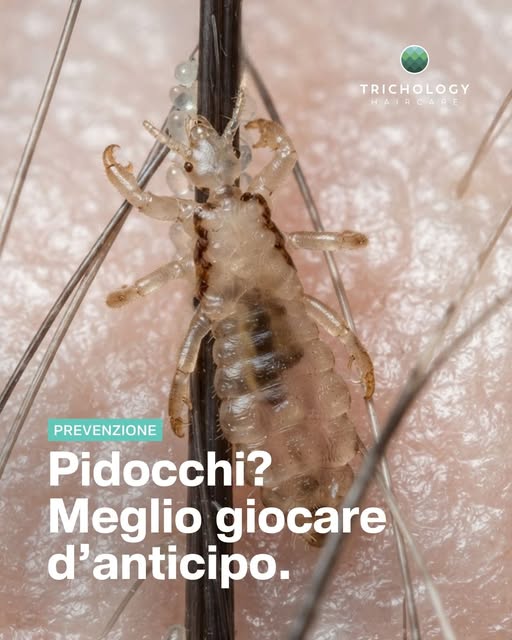 La scuola sta per ricominciare. E questa è un’immagine che nessun genitore vorrebbe vedere.
Quello c