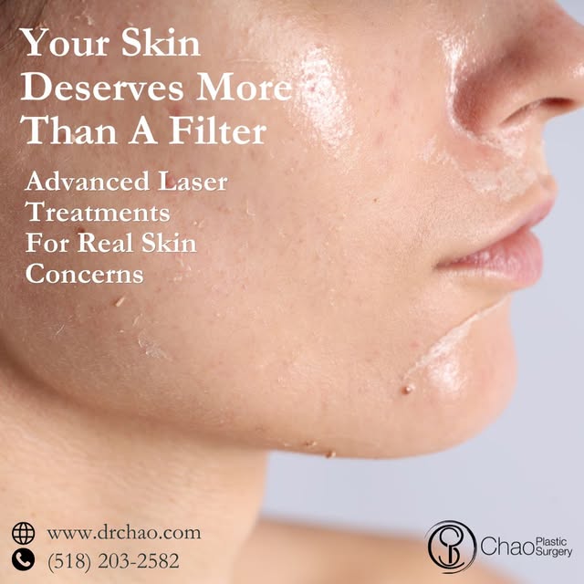 Filters can temporarily change the way your skin looks, but professional laser treatments can addres