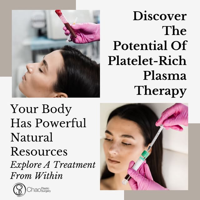 Platelet-rich plasma, or PRP , and platelet-rich fibrin matrix or PRFM use components from your own 