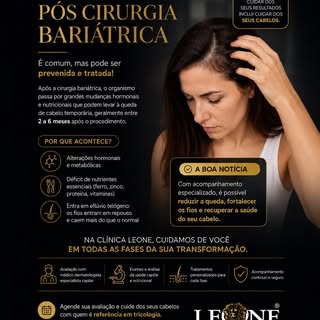 **Queda de cabelo após cirurgia bariátrica: por que isso acontece?** 🦁✨

Após a cirurgia bariátrica