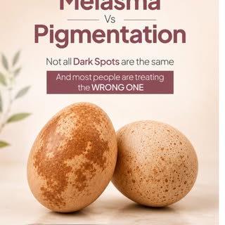 Melasma and pigmentation may look similar, but they need completely different treatments. Treating t