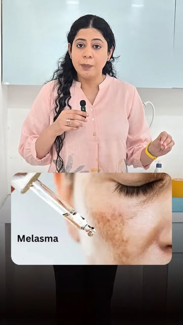 Melasma isn't "permanent" — you just need the right approach. ✨

In Part 4, Dr. Jaspreet covers the 