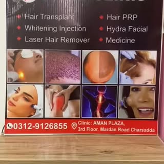 #smilehairtranspant #charsadda #skincare #prptreatment #amanplaza #03129126855