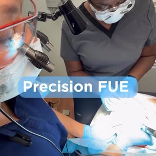 Expert FUE requires exact vision and precision to secure the best quality grafts