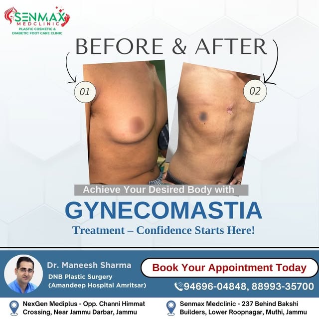 Redefine Your Chest, Redefine Yourself! Gynecomastia? Let’s Take Care of It Together!

Set up an app