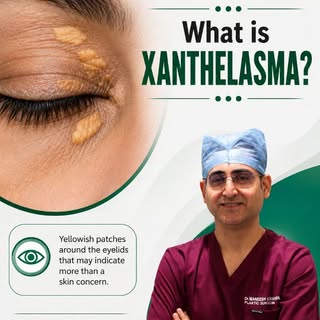 Yellowish patches around your eyes? It could be Xanthelasma. 

Xanthelasma is a common condition tha