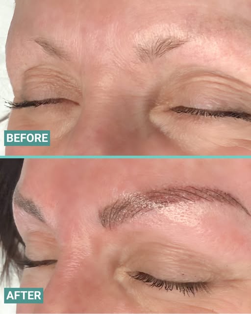 Hair loss shows up in the brows, too. 🤍 Thinning, over-plucked, or sparse arches get a natural refr