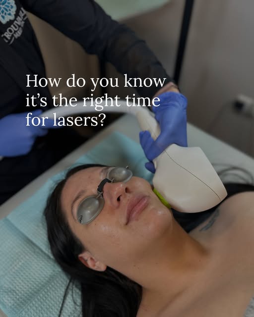 Laser season is approaching! Do you see signs from the sun that you are looking to correct?👀 - Swip