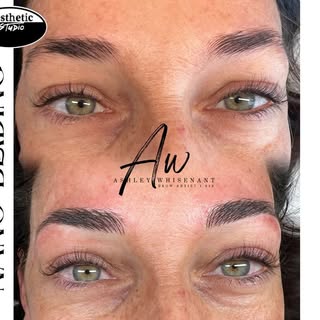 Ashley's from Aesthetic Studio help this client to showcase her brows with NanoBlading. She can now 