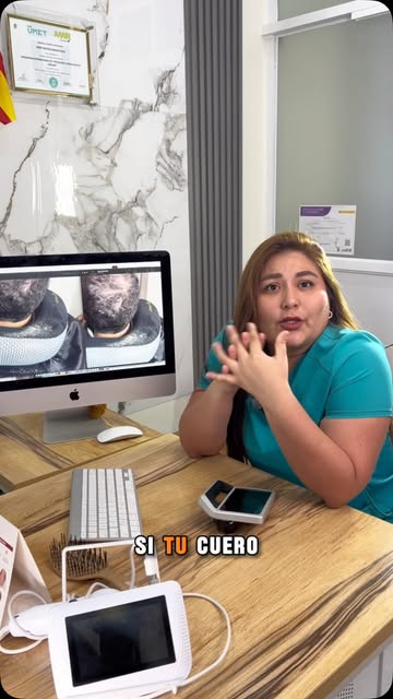 😣🔥 ¿Tu cuero cabelludo pica todos los días? ¡No lo normalices! ⚠️💇‍♀️💇‍♂️

La picazón constante,