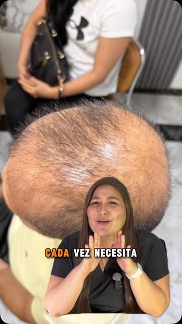 🧬💇‍♂️ ¿Cada vez necesitas más cabello para cubrir menos cabello? 😔👀

Las entradas avanzan, la co