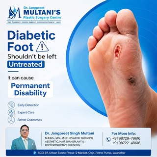 Don’t ignore a diabetic foot wound—it can become a serious complication if left untreated.

Early di