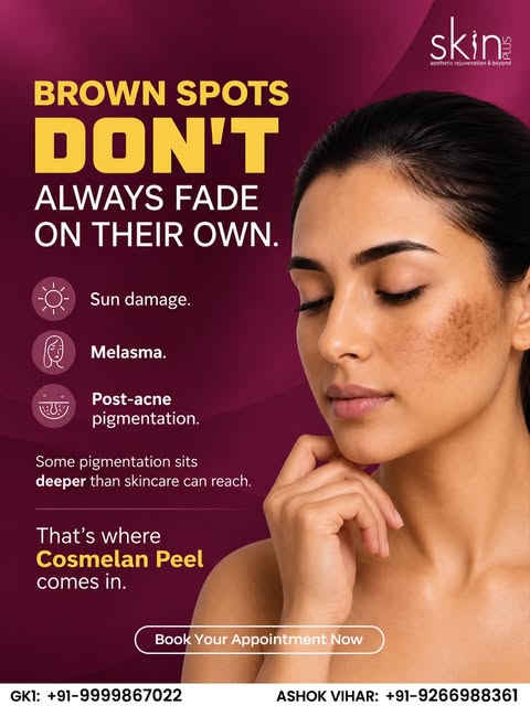 Brown spots don’t always fade on their own. ☀️ From sun damage and melasma to post-acne pigmentation