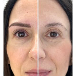 Una combinazione di due trattamenti delicati ma efficaci: 
✔️ Dermopigmentazione sopracciglia con te