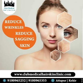 * Wrinkles Removal Treatment @Clubmedical
* Start's @999/-*
* Book Your Consultation Today!
* Visit 