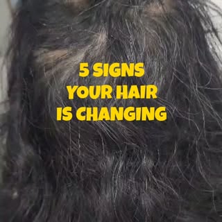Your hair rarely changes overnight. More often, the early signs are subtle — and easy to ignore. 👀
