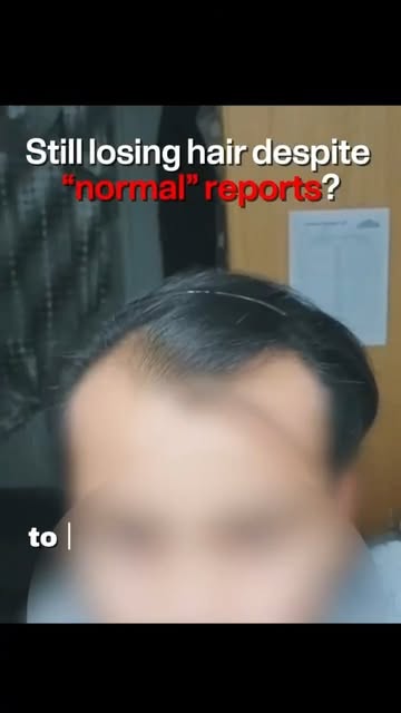 Hair loss can be a lot more complicated than it looks. When shedding continues despite trying differ