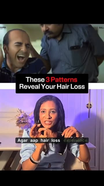 These 3 patterns could reveal the cause. 👀

Hair loss isn’t always genetic.

When I evaluate hair l