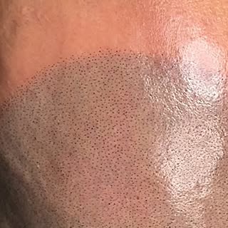 🔍 The Importance of SMP Maintenance 🔍

Did you know that Scalp Micropigmentation (SMP) requires re
