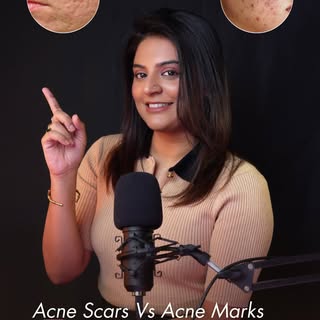 Acne scars and acne marks look similar but behave completely differently—which is why your treatment