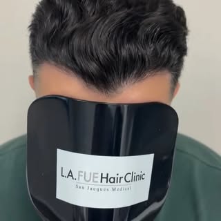 Six months in and this is only halfway. 👏

Russ came back to LA FUE Hair Clinic for his 6 month fol