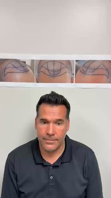 Three years later and the results speak for themselves.

This patient returned nearly 3 years after 