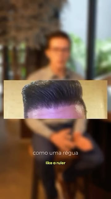 @drdanieldourado Uma linha frontal extremamente reta pode parecer, à primeira vista, uma escolha est
