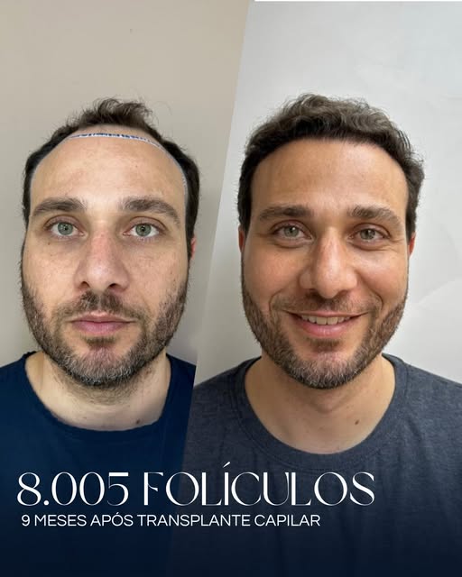 9 meses entre o antes e o depois — e uma transformação construída com planejamento, precisão e natur