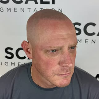 Active duty military travels from Texas for an Amazing Touch Up 😳 💥 First touch up in 5 years💪🏼C