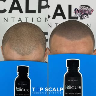 Density Restored !!! 🙏🏼 Amazing Final Results 💥 💪🏼Choose wisely 🫡 Zoom in on this beautiful Fi