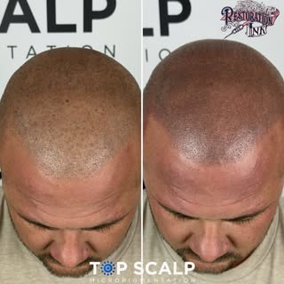 Density treatment 💥 This was 1 session with us! BOOM✍🏼 💙Call for your free consultation 📞 😎 Thi