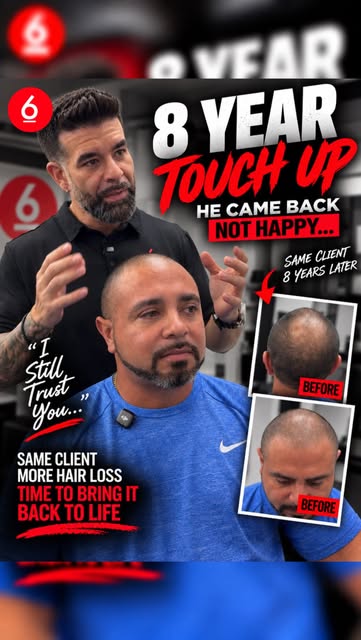 HE CAME BACK 8 YEARS LATER… AND HIS SMP WASN’T THE PROBLEM. 😳

I did his original scalp micropigmen