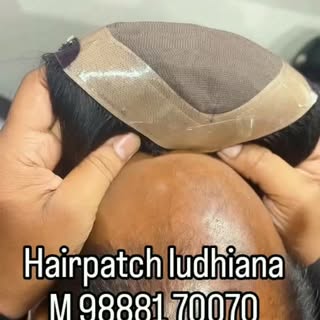 #hairaptch #wig #instagram #viralreels❤️ #wiginstall 
Malhotrahairpatch hairpatch ludhiana
M 82839  