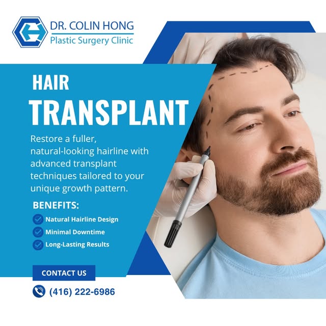 Restore a fuller, natural-looking hairline with advanced transplant techniques tailored to your uniq