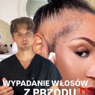 Zauważyłaś, że włosy wypadają szczególnie z przodu? 😟
To bardzo częsty problem — często przez zbyt 