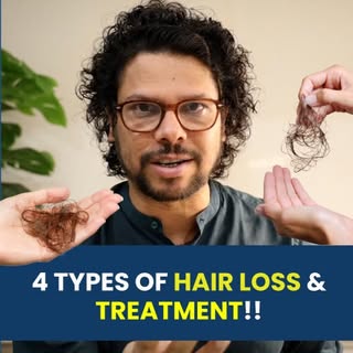 4 types of Hair Loss & Treatment | Hair Growth | Hair Tips | Hair Expert | Adon Hair Care#viralshort