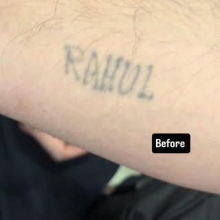 Rahul , Naam toh sunna hi hoga ???
No more regretting over tattoos ✔️