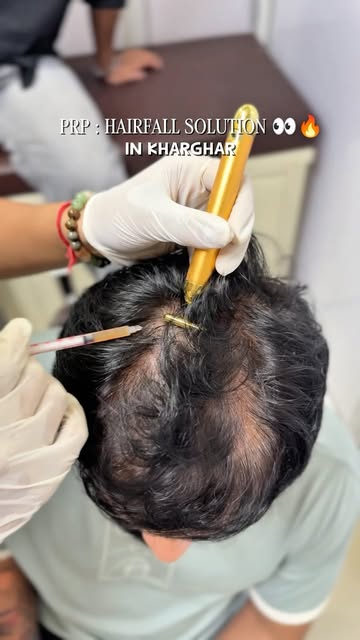 Abh Hairfall band hoga Ft @dermstrata.clinic.kharghar 🤗
•
Shop no.13, GOKULDHAM SOCIETY, opp. Baghb