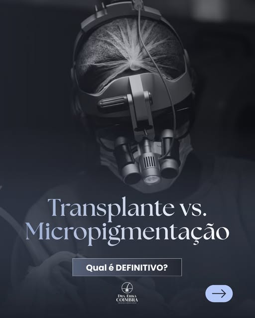 Transplante capilar ou Micropigmentação? 

Enquanto a micropigmentação cria um efeito visual de pree
