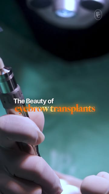 Cada cirurgia é uma nova oportunidade de transformar histórias e devolver a confiança!

Neste vídeo,