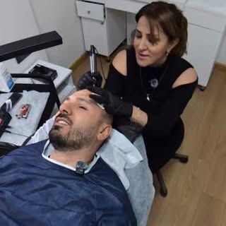 Saç pigmentasyonu işlemi, saç derisine uygulanan özel pigmentlerle saç yoğunluğu görünümü kazandıran