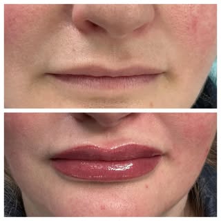 LIP BLUSHING TRANSFORMATION
Natural definition. Balanced color. Effortless confidence.
This client w
