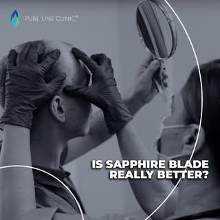 You ask, we answer. Hair transplantation FAQ:
“Is Sapphire Blade really better for hair transplantat