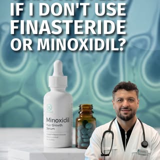 You ask, we answer. Hair transplantation FAQ:
“What happens if I don’t use Finasteride or Minoxidil?