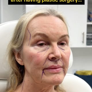 Is 63 the new 43? 🤔 Her goal was never to look “younger”, it was to look and FEEL like herself agai