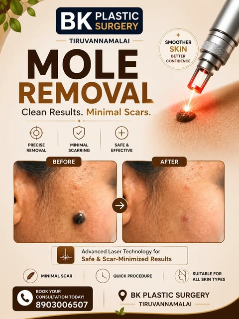 L
✨ Mole bothering you?
Get expert evaluation and explore laser-assisted mole removal with minimal s
