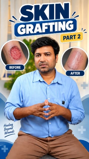 Skin Grafting – Part 2
Restoring damaged skin, supporting healing and helping you move forward with 