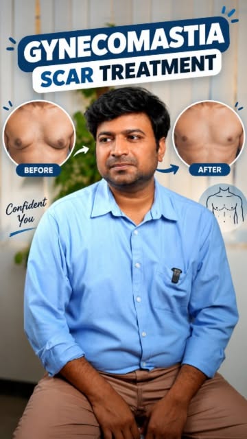 Gynecomastia can affect confidence — but treatment options are available. 💙
Learn about gynecomasti
